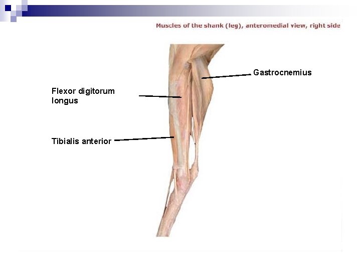 Gastrocnemius Flexor digitorum longus Tibialis anterior 