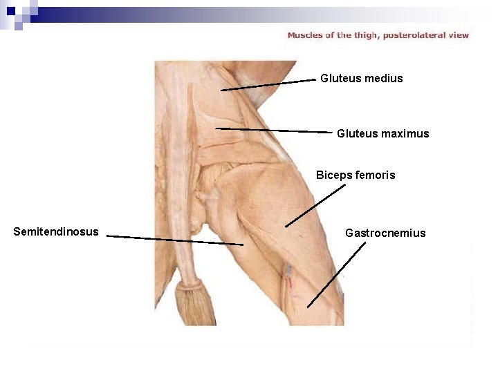 Gluteus medius Gluteus maximus Biceps femoris Semitendinosus Gastrocnemius 