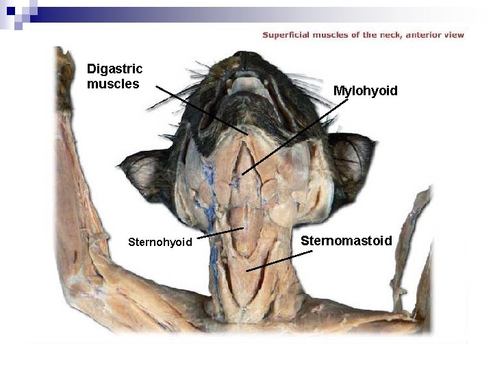 Digastric muscles Sternohyoid Mylohyoid Sternomastoid 