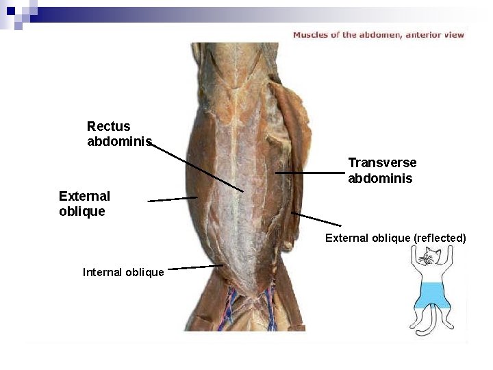 Rectus abdominis Transverse abdominis External oblique (reflected) Internal oblique 