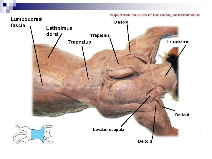 Lumbodorsal fascia Deltoid Latissimus dorsi Trapezius Deltoid Levator scapula Deltoid 