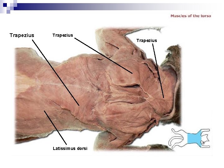 Trapezius Latissimus dorsi 