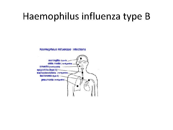 Haemophilus influenza type B 