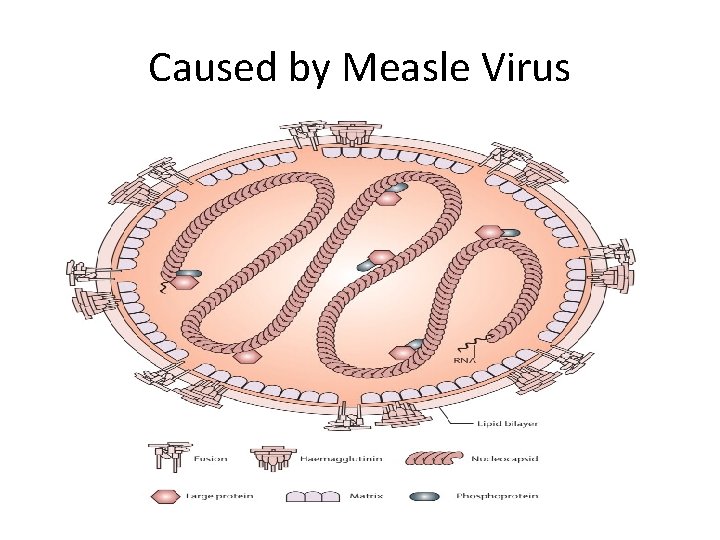 Caused by Measle Virus 