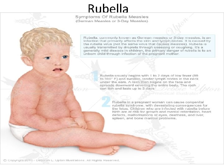 Rubella 