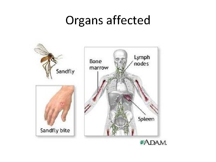 Organs affected 