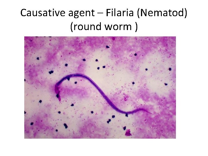 Causative agent – Filaria (Nematod) (round worm ) 