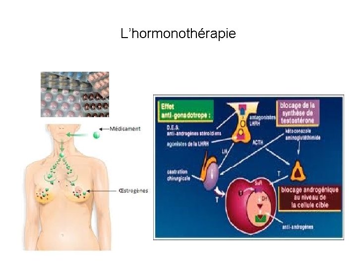 L’hormonothérapie 