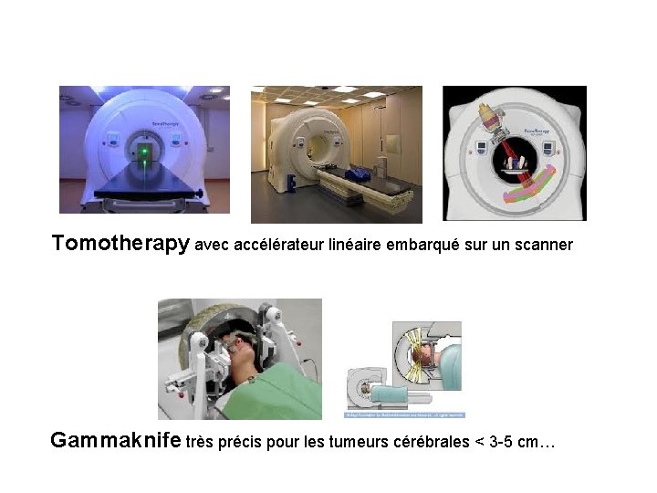 Tomotherapy avec accélérateur linéaire embarqué sur un scanner Gammaknife très précis pour les tumeurs