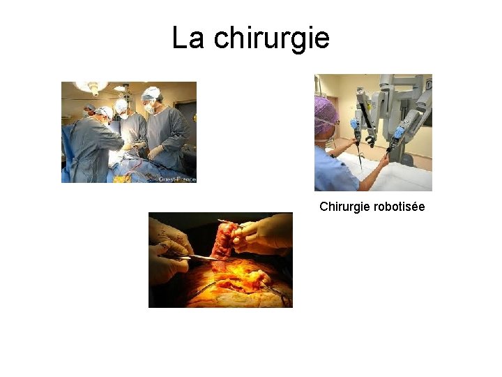 La chirurgie Chirurgie robotisée 