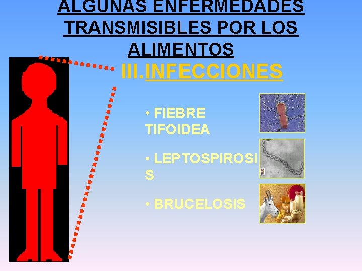 ALGUNAS ENFERMEDADES TRANSMISIBLES POR LOS ALIMENTOS III. INFECCIONES • FIEBRE TIFOIDEA • LEPTOSPIROSI S