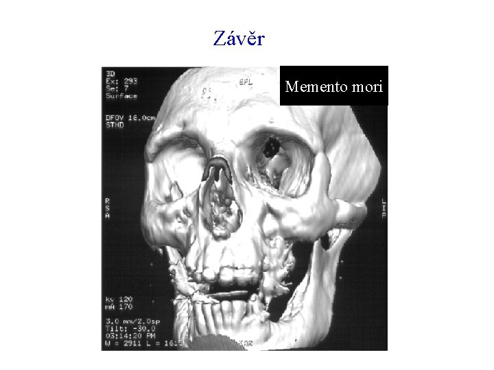 Závěr Memento mori 