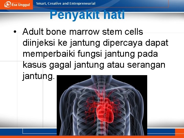 Penyakit hati • Adult bone marrow stem cells diinjeksi ke jantung dipercaya dapat memperbaiki