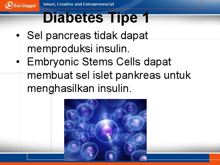 Diabetes Tipe 1 • Sel pancreas tidak dapat memproduksi insulin. • Embryonic Stems Cells