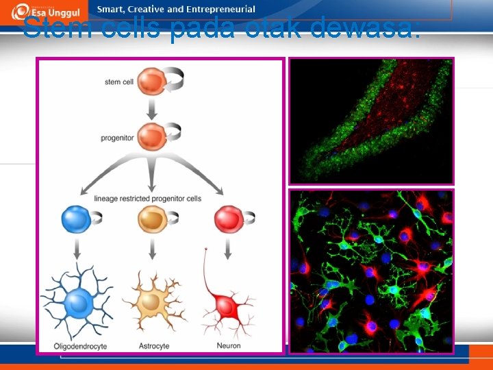 Stem cells pada otak dewasa: 