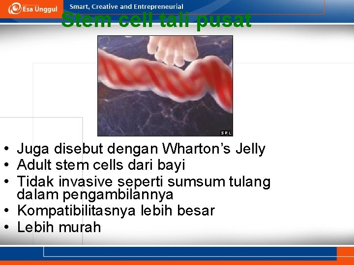 Stem cell tali pusat • Juga disebut dengan Wharton’s Jelly • Adult stem cells