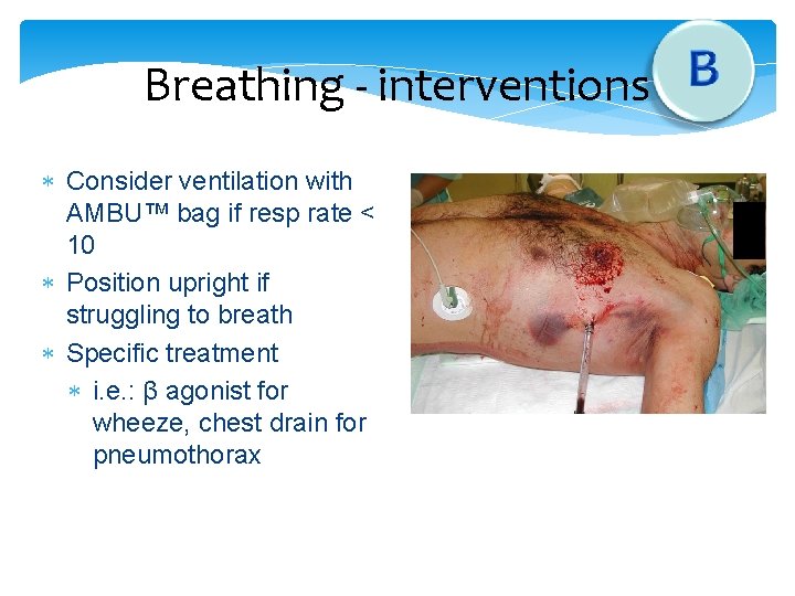 Breathing - interventions Consider ventilation with AMBU™ bag if resp rate < 10 Position