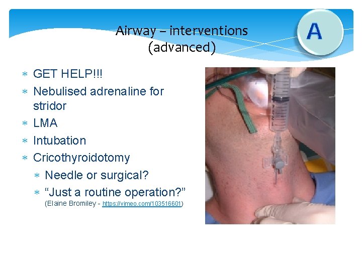 Airway – interventions (advanced) GET HELP!!! Nebulised adrenaline for stridor LMA Intubation Cricothyroidotomy Needle