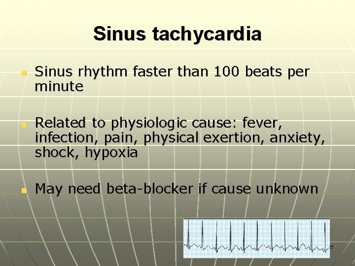 Sinus tachycardia n n n Sinus rhythm faster than 100 beats per minute Related