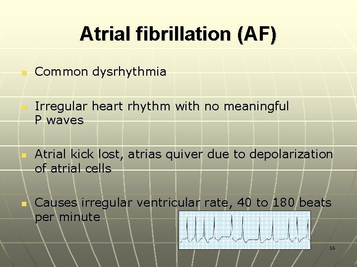 Atrial fibrillation (AF) n n Common dysrhythmia Irregular heart rhythm with no meaningful P