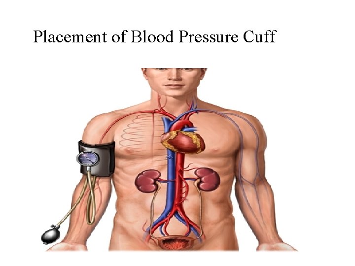 Placement of Blood Pressure Cuff 