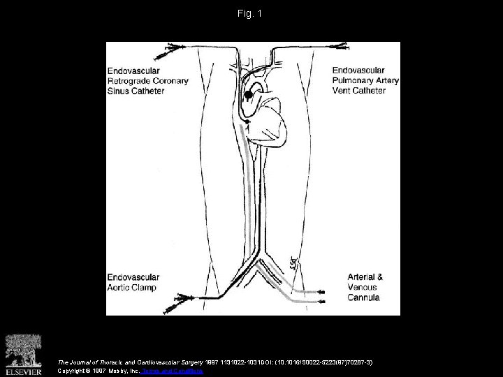Fig. 1 The Journal of Thoracic and Cardiovascular Surgery 1997 1131022 -1031 DOI: (10.