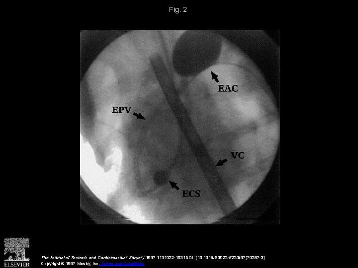 Fig. 2 The Journal of Thoracic and Cardiovascular Surgery 1997 1131022 -1031 DOI: (10.