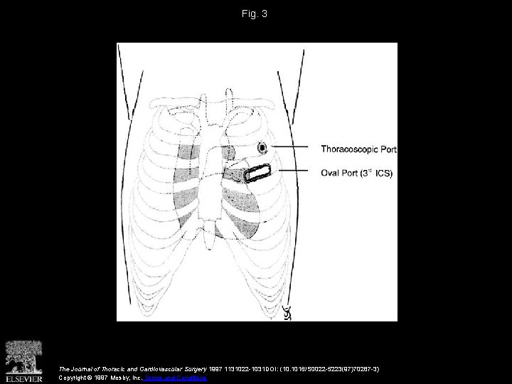 Fig. 3 The Journal of Thoracic and Cardiovascular Surgery 1997 1131022 -1031 DOI: (10.