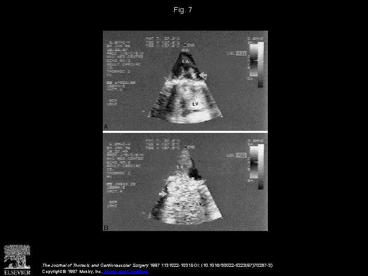 Fig. 7 The Journal of Thoracic and Cardiovascular Surgery 1997 1131022 -1031 DOI: (10.