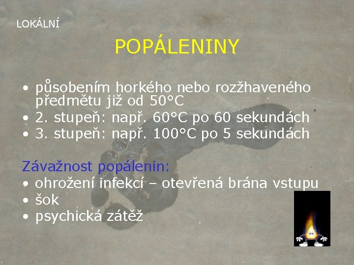 LOKÁLNÍ POPÁLENINY • působením horkého nebo rozžhaveného předmětu již od 50°C • 2. stupeň: