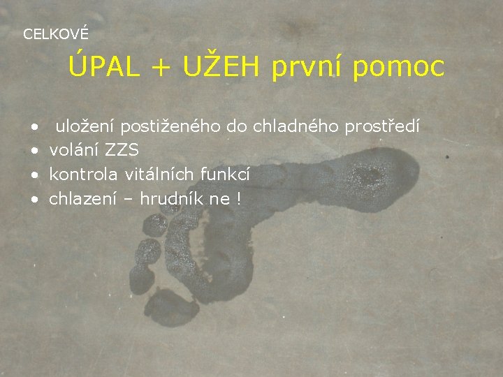 CELKOVÉ ÚPAL + UŽEH první pomoc • • uložení postiženého do chladného prostředí volání