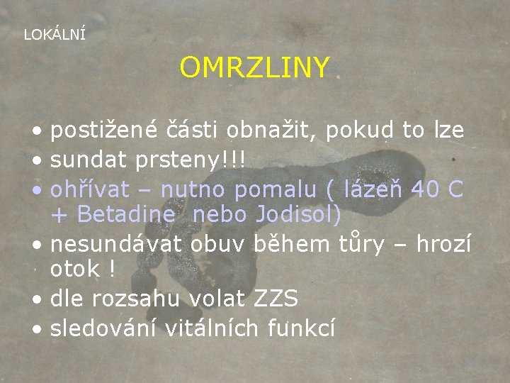 LOKÁLNÍ OMRZLINY • postižené části obnažit, pokud to lze • sundat prsteny!!! • ohřívat