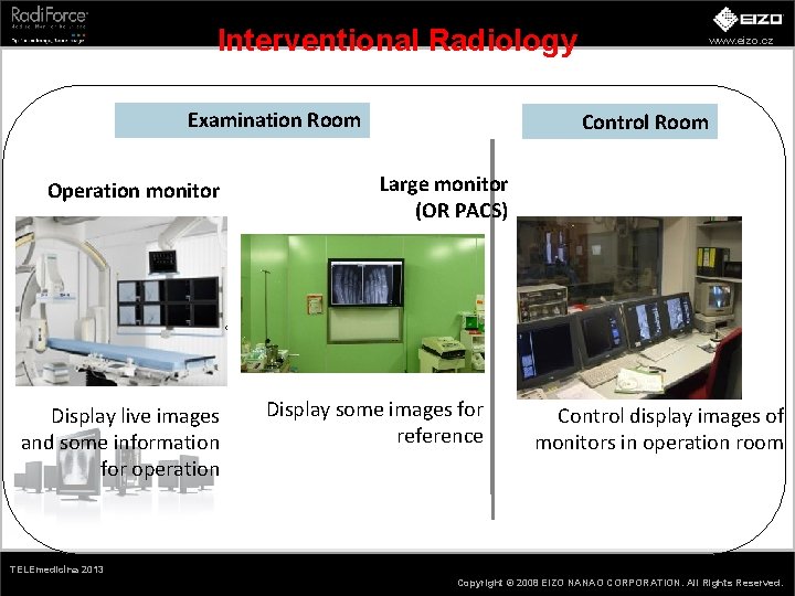 Interventional Radiology Examination Room Operation monitor Display live images and some information for operation