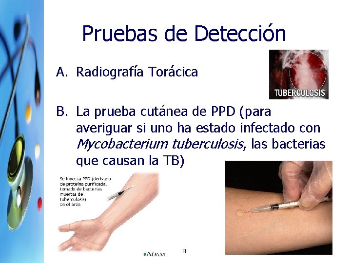 Pruebas de Detección A. Radiografía Torácica B. La prueba cutánea de PPD (para averiguar