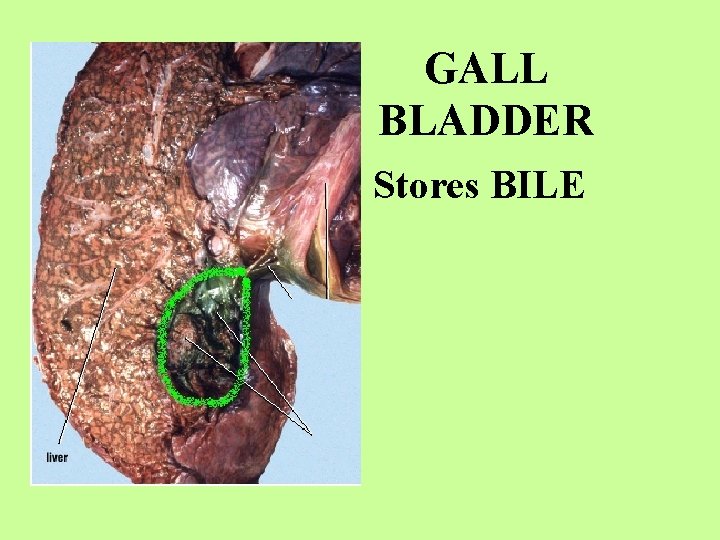 GALL BLADDER Stores BILE 