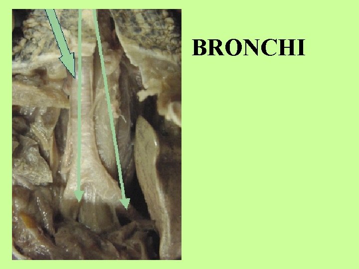 BRONCHI 