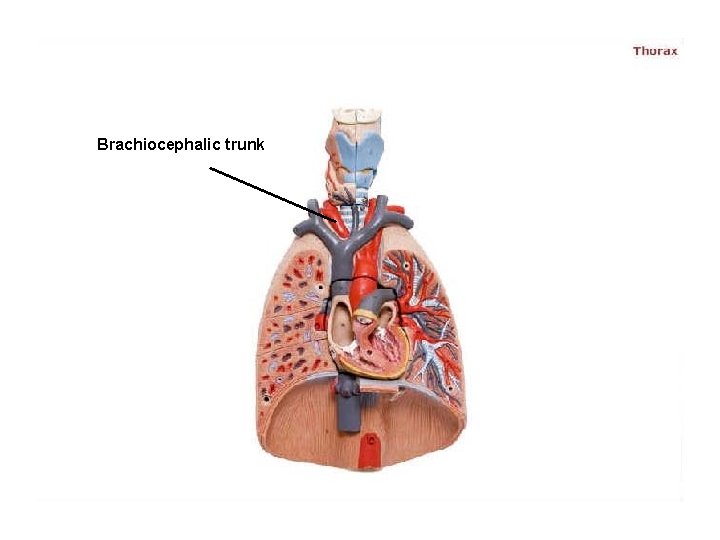 Brachiocephalic trunk 