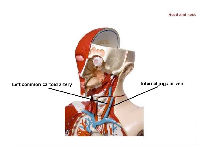 Left common cartoid artery Internal jugular vein 