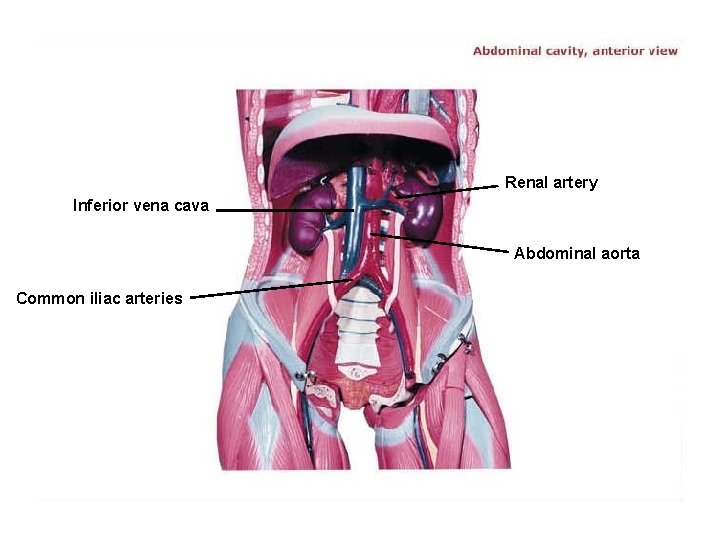 Renal artery Inferior vena cava Abdominal aorta Common iliac arteries 