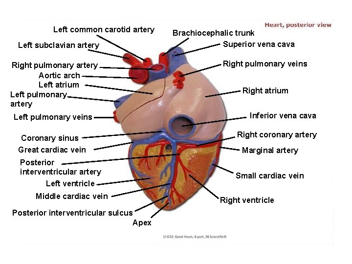 Left common carotid artery Left subclavian artery Right pulmonary artery Aortic arch Left atrium