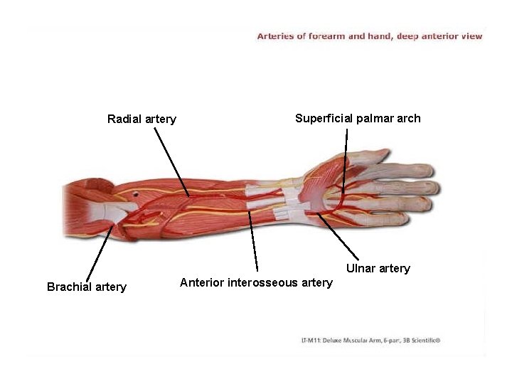 Radial artery Superficial palmar arch Ulnar artery Brachial artery Anterior interosseous artery 