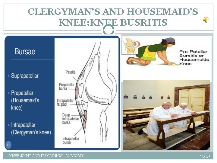 CLERGYMAN’S AND HOUSEMAID’S KNEE: KNEE BUSRITIS KNEE JOINT AND ITS CLINICAL ANATOMY 25/30 