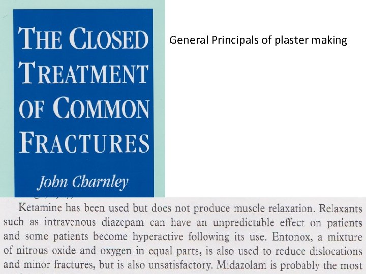 General Principals of plaster making 