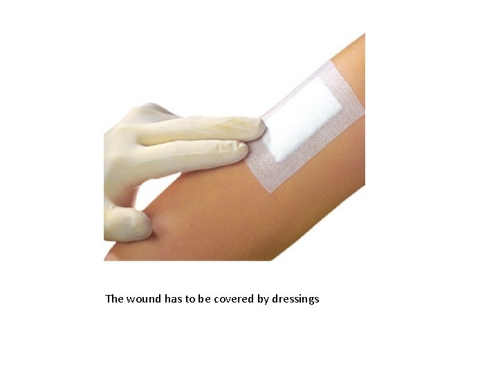 The wound has to be covered by dressings 