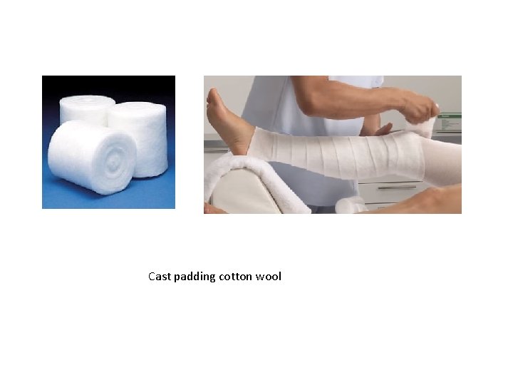 Cast padding cotton wool 