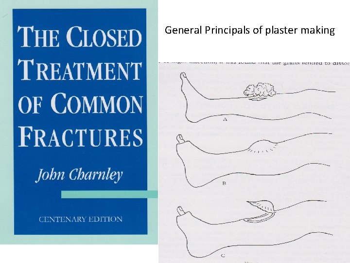 General Principals of plaster making 