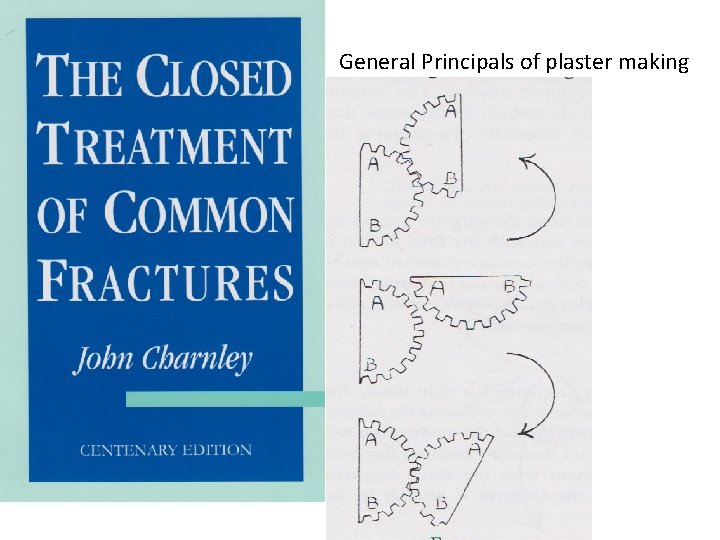 General Principals of plaster making 