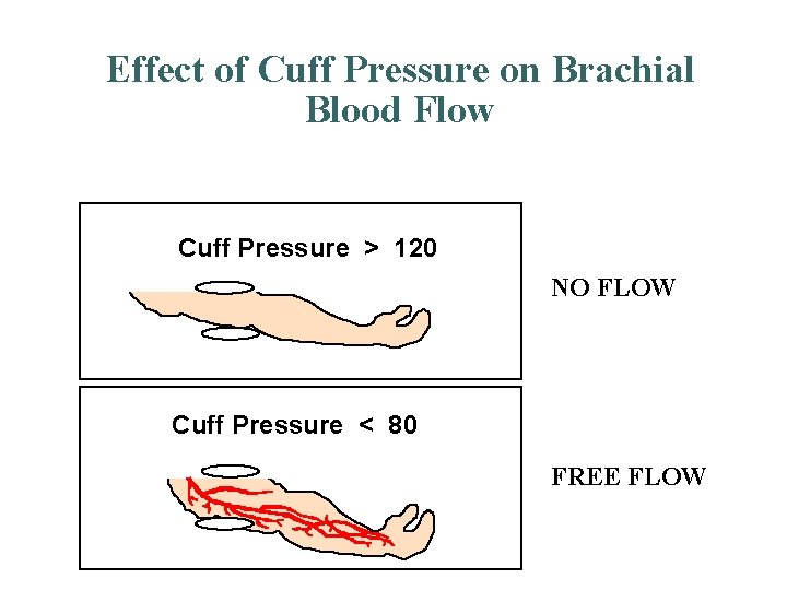 Effect of Cuff Pressure on Brachial Blood Flow Cuff Pressure > 120 NO FLOW