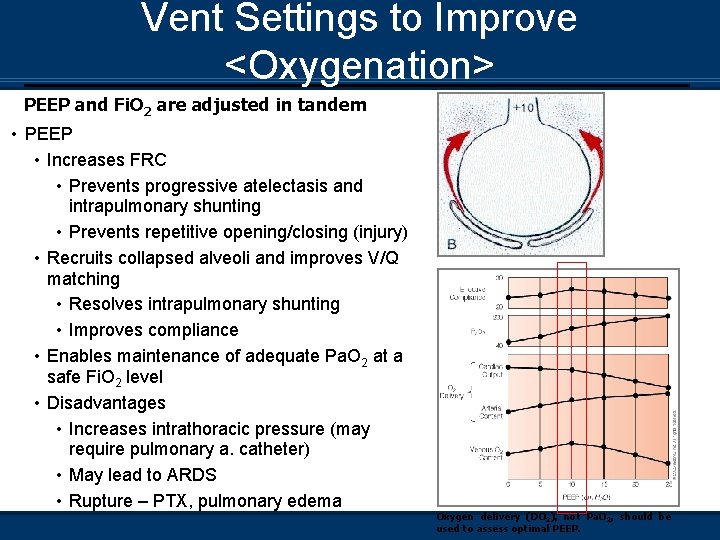 Vent Settings to Improve <Oxygenation> PEEP and Fi. O 2 are adjusted in tandem