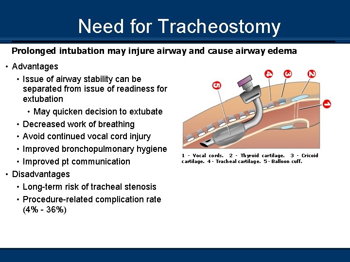 Need for Tracheostomy Prolonged intubation may injure airway and cause airway edema • Advantages